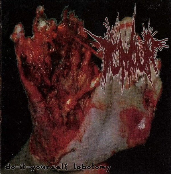 Anal Penetration – Do-It-Yourself Lobotomy / The Daily Drop (2022) CD